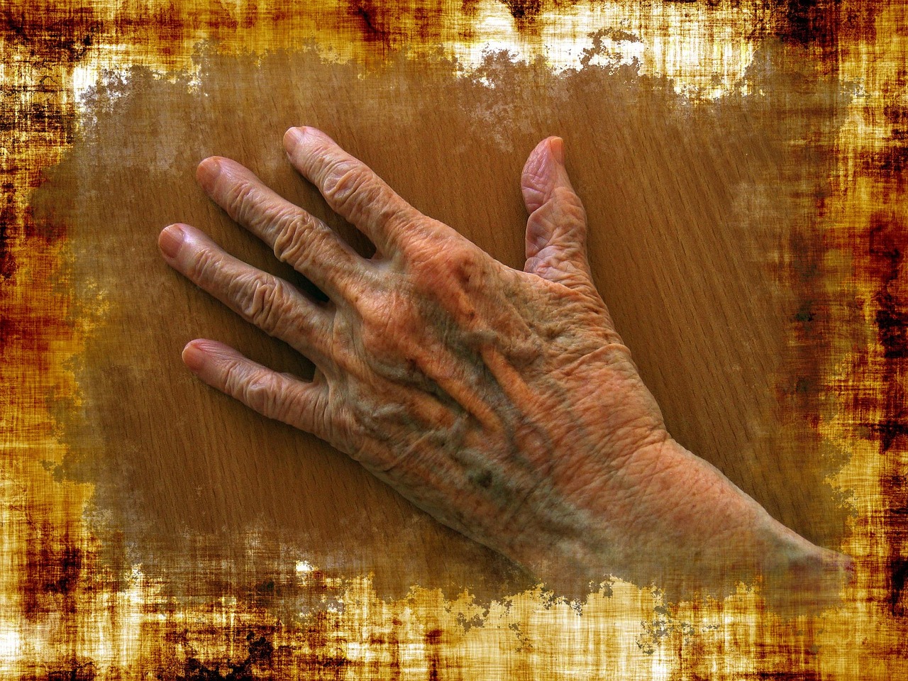 Rheumatoid Arthritis